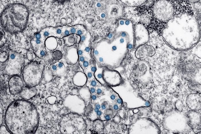 Coronavirus particles (in blue), seen under an electron microscope 