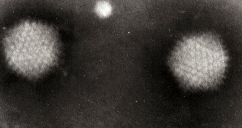 Adenoviruses: an electron micrograph of two Adenovirus particles