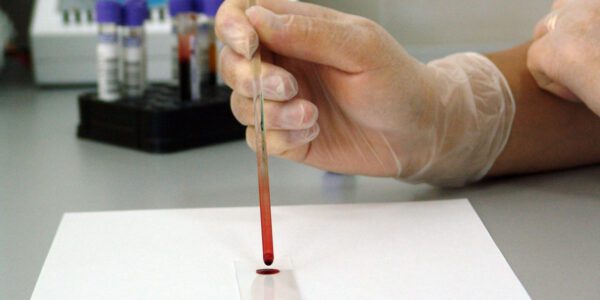 blood test in a lab