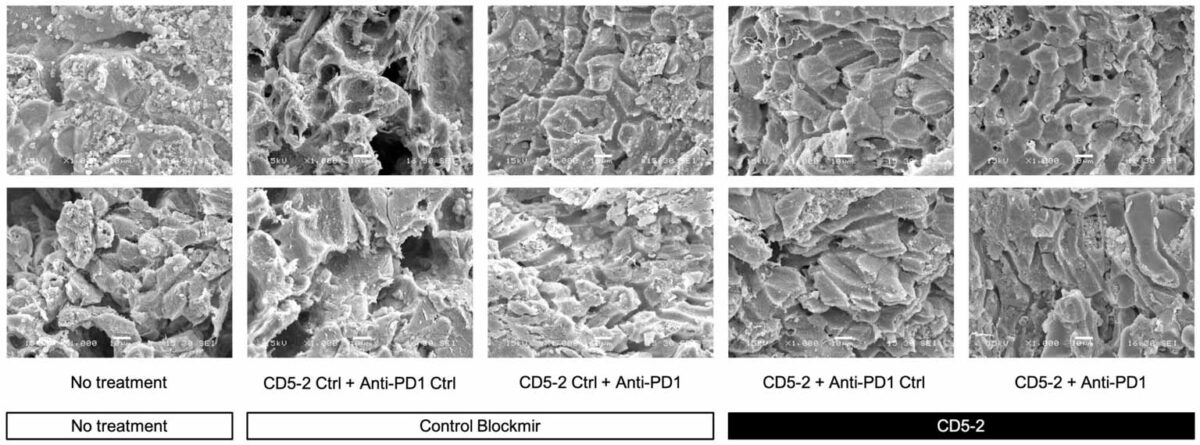 CD5-2 treatment improved tumour vessels structure. Representative scanning electron microscopy images of liver tumour blood vessels in the different treatment groups. Qualitatively, tumour blood vessels appeared to be more regular and well-organized in mice from groups treated with CD5-2 compared to control Blockmir or no treatment. Credit: Frontiers in Immunology (2023). DOI: 10.3389/fimmu.2023.1245708